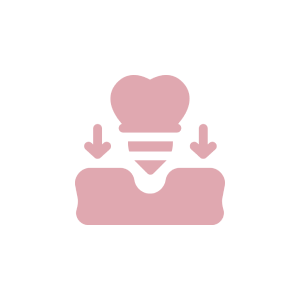 Tooth implant icon with downward arrows.