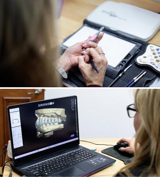 Dental design and modeling on computer.