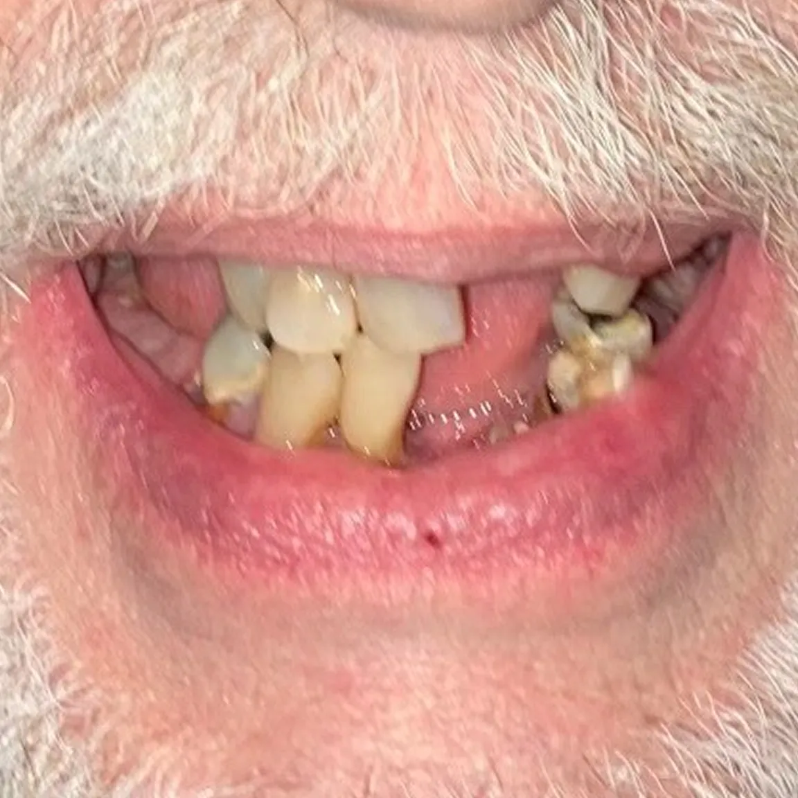 Close-up of a person's teeth and beard.