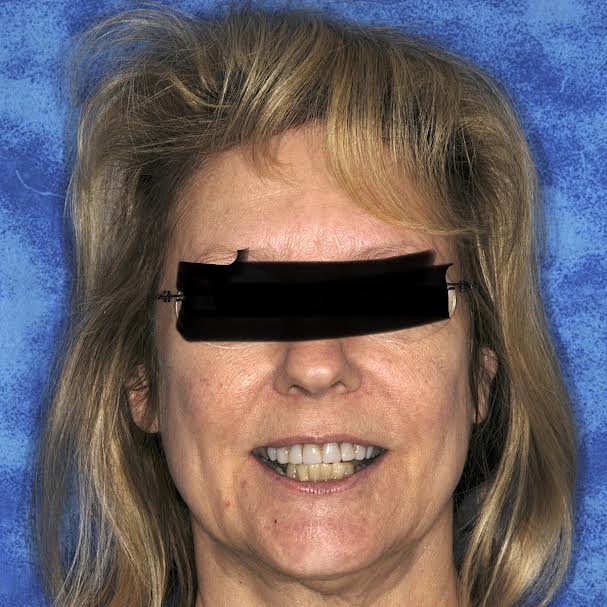Smiling person with obscured eyes, blue background.