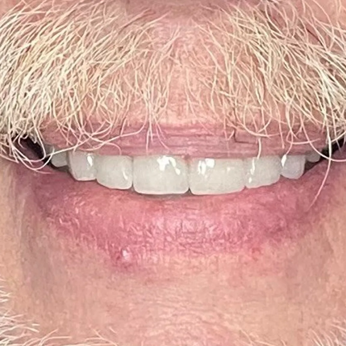 Smiling person with a mustache close-up.