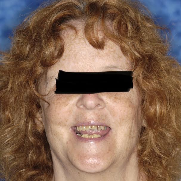 Smiling person with curly hair and teeth.