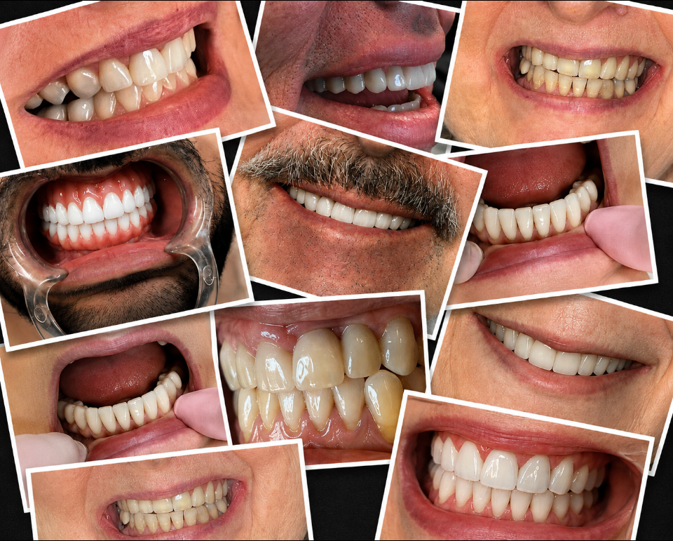 Collage of various smiling teeth close-ups.
