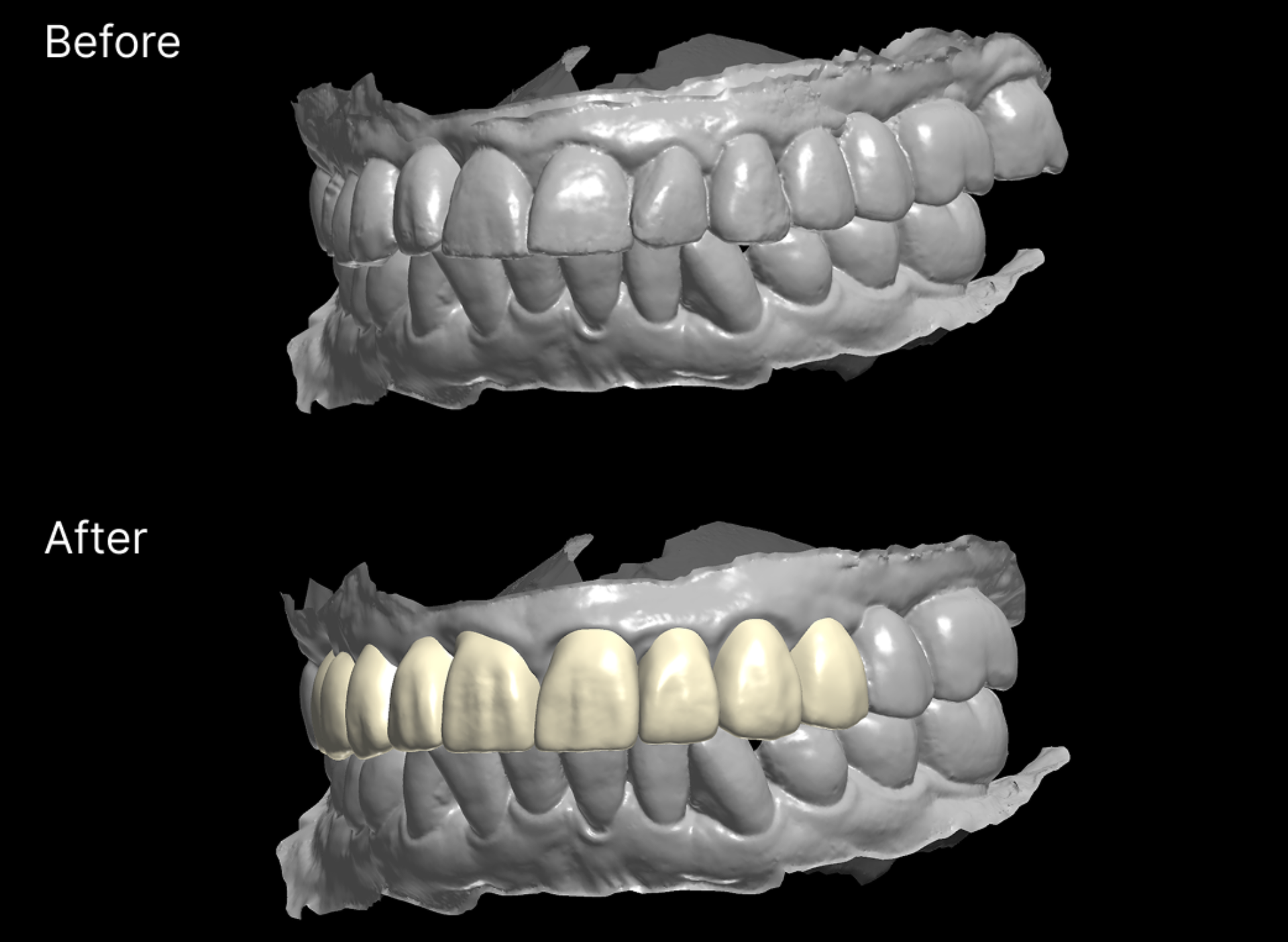 Before and after dental treatment comparison.